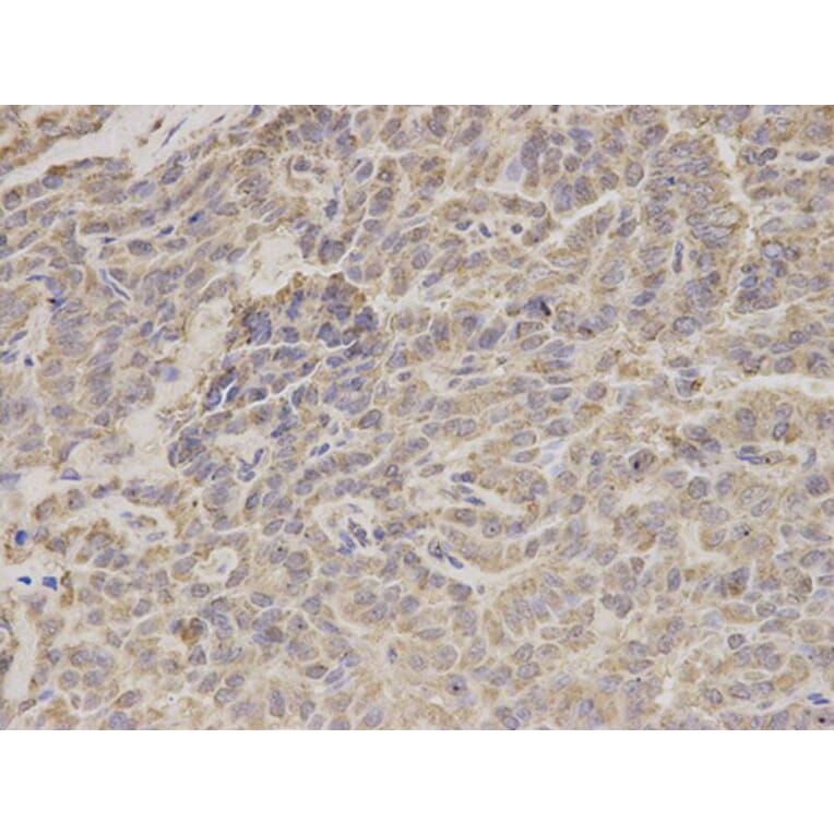 Immunohistochemistry - HADHA Antibody from Signalway Antibody (32787) - Antibodies.com