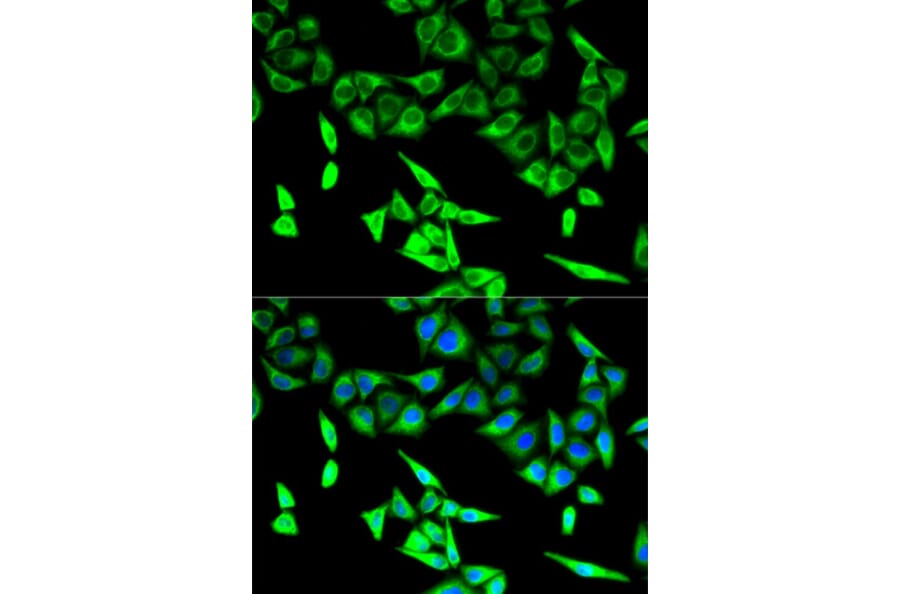Immunofluorescence - HADHA Antibody from Signalway Antibody (32787) - Antibodies.com