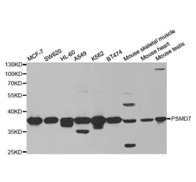 Western blot - PSMD7 Antibody from Signalway Antibody (32796) - Antibodies.com