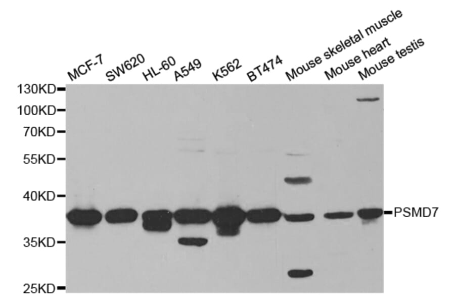 Western blot - PSMD7 Antibody from Signalway Antibody (32796) - Antibodies.com