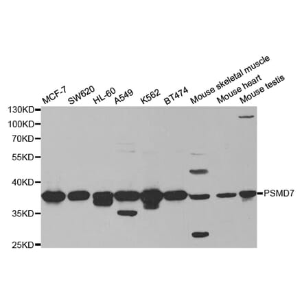 Western blot - PSMD7 Antibody from Signalway Antibody (32796) - Antibodies.com
