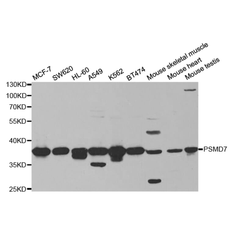 Western blot - PSMD7 Antibody from Signalway Antibody (32796) - Antibodies.com
