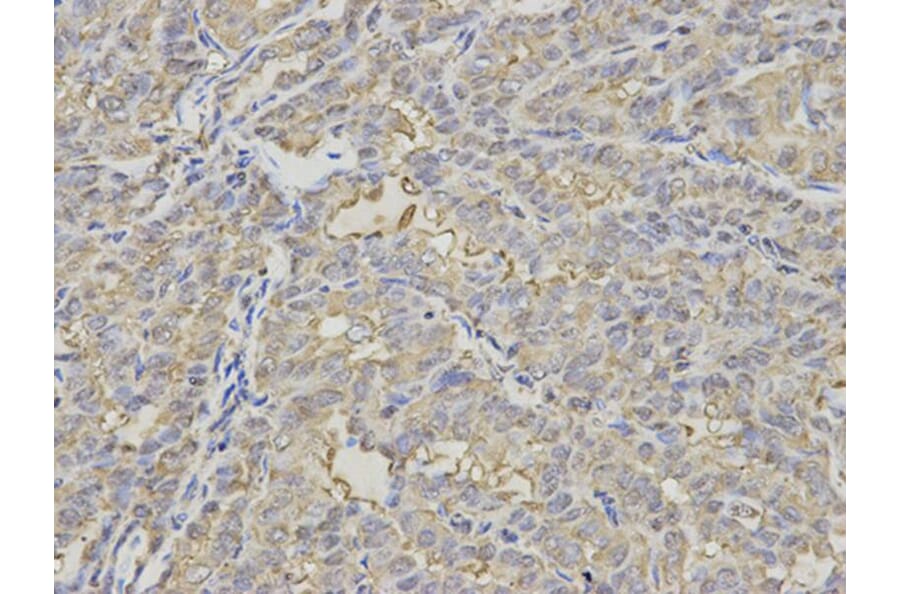 Immunohistochemistry - PSMD7 Antibody from Signalway Antibody (32796) - Antibodies.com