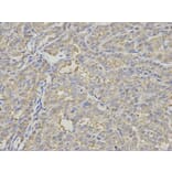Immunohistochemistry - PSMD7 Antibody from Signalway Antibody (32796) - Antibodies.com