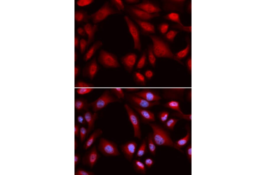 Immunofluorescence - PSMD7 Antibody from Signalway Antibody (32796) - Antibodies.com