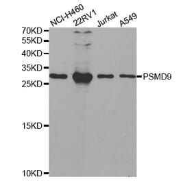 Western blot - PSMD9 Antibody from Signalway Antibody (32797) - Antibodies.com