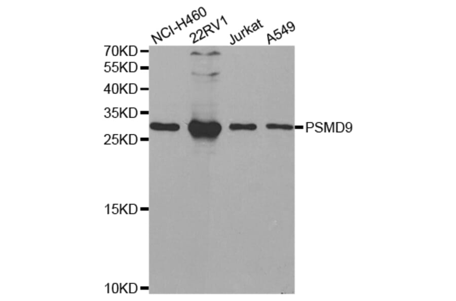 Western blot - PSMD9 Antibody from Signalway Antibody (32797) - Antibodies.com