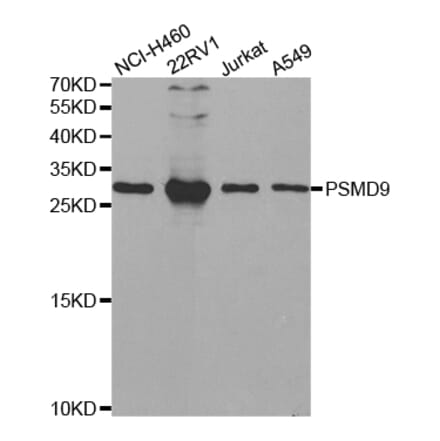 Western blot - PSMD9 Antibody from Signalway Antibody (32797) - Antibodies.com