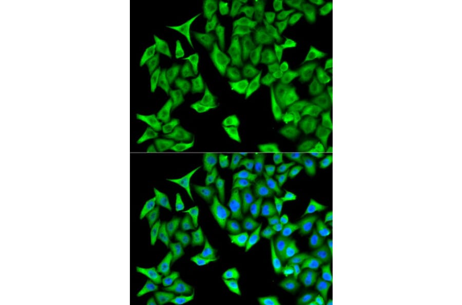 Immunofluorescence - PSMD9 Antibody from Signalway Antibody (32797) - Antibodies.com