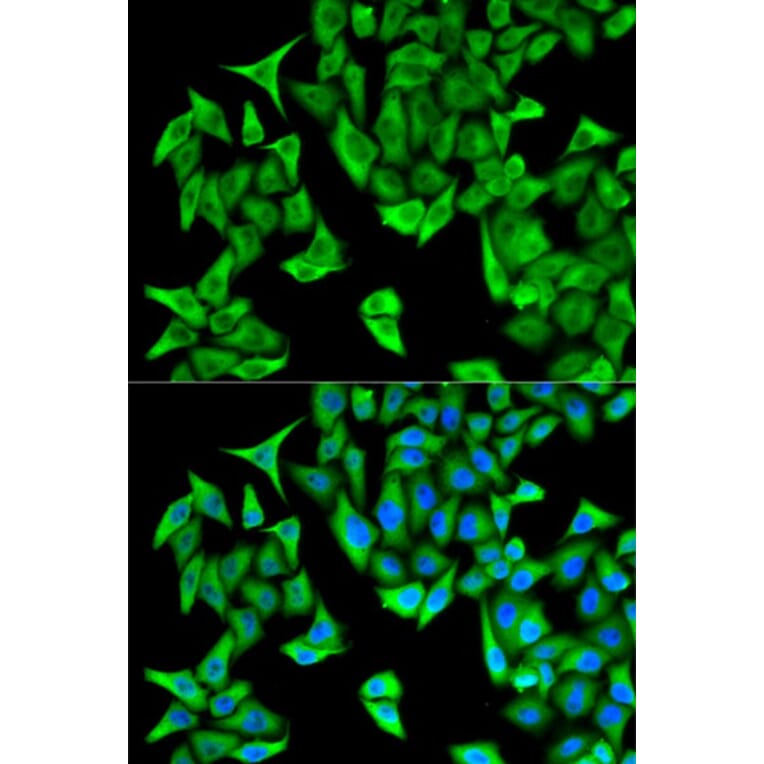 Immunofluorescence - PSMD9 Antibody from Signalway Antibody (32797) - Antibodies.com