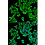 Immunofluorescence - PSMD9 Antibody from Signalway Antibody (32797) - Antibodies.com