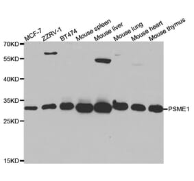 Western blot - PSME1 Antibody from Signalway Antibody (32798) - Antibodies.com