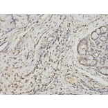 Immunohistochemistry - PSME1 Antibody from Signalway Antibody (32798) - Antibodies.com