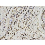 Immunohistochemistry - PSME1 Antibody from Signalway Antibody (32798) - Antibodies.com