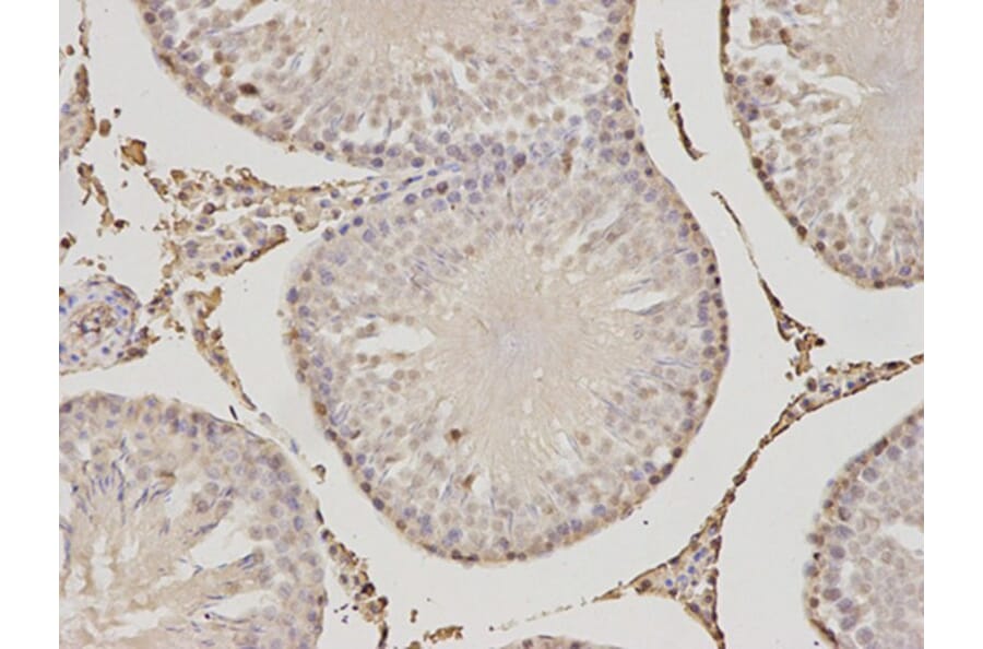 Immunohistochemistry - PSME1 Antibody from Signalway Antibody (32798) - Antibodies.com