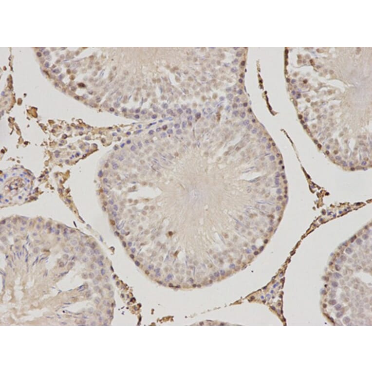 Immunohistochemistry - PSME1 Antibody from Signalway Antibody (32798) - Antibodies.com