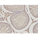 Immunohistochemistry - PSME1 Antibody from Signalway Antibody (32798) - Antibodies.com