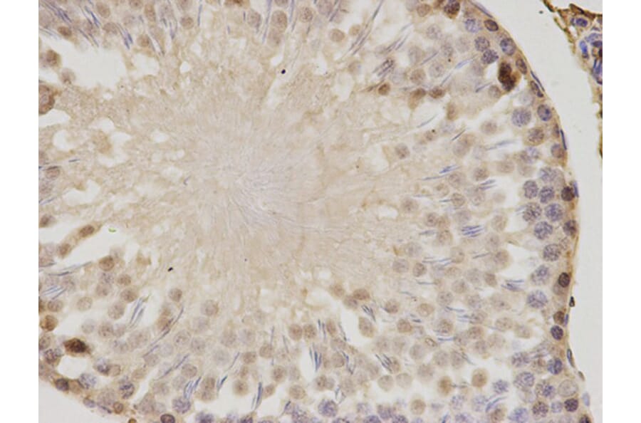 Immunohistochemistry - PSME1 Antibody from Signalway Antibody (32798) - Antibodies.com