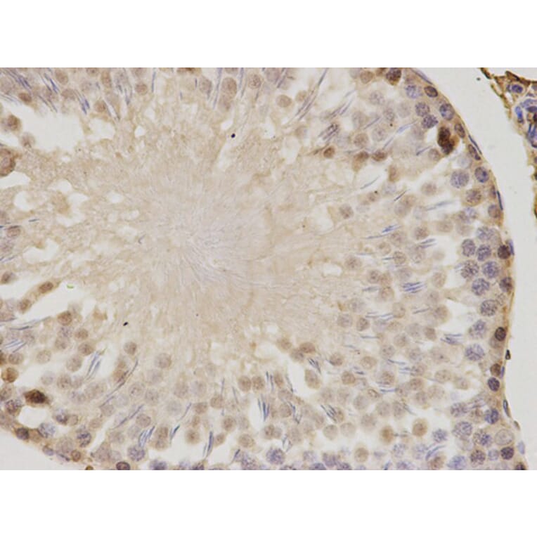 Immunohistochemistry - PSME1 Antibody from Signalway Antibody (32798) - Antibodies.com