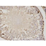 Immunohistochemistry - PSME1 Antibody from Signalway Antibody (32798) - Antibodies.com