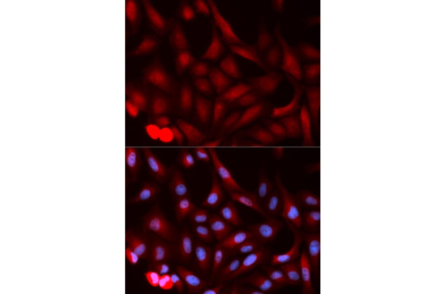 Immunofluorescence - PSME1 Antibody from Signalway Antibody (32798) - Antibodies.com