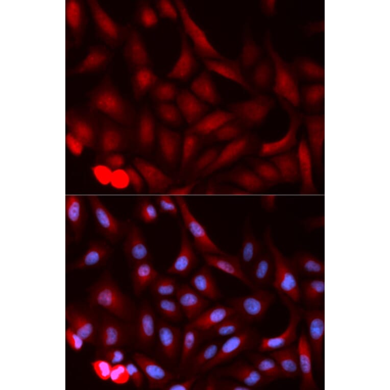 Immunofluorescence - PSME1 Antibody from Signalway Antibody (32798) - Antibodies.com