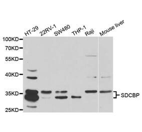 Western blot - SDCBP Antibody from Signalway Antibody (32800) - Antibodies.com