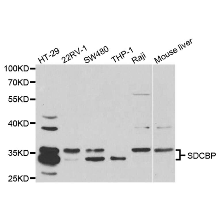 Western blot - SDCBP Antibody from Signalway Antibody (32800) - Antibodies.com