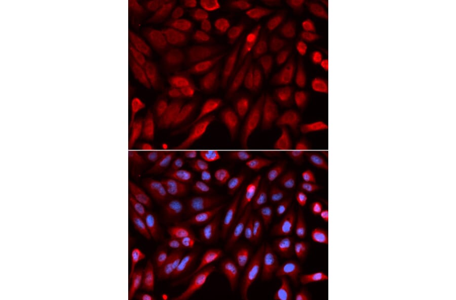 Immunofluorescence - SDCBP Antibody from Signalway Antibody (32800) - Antibodies.com