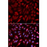 Immunofluorescence - SDCBP Antibody from Signalway Antibody (32800) - Antibodies.com