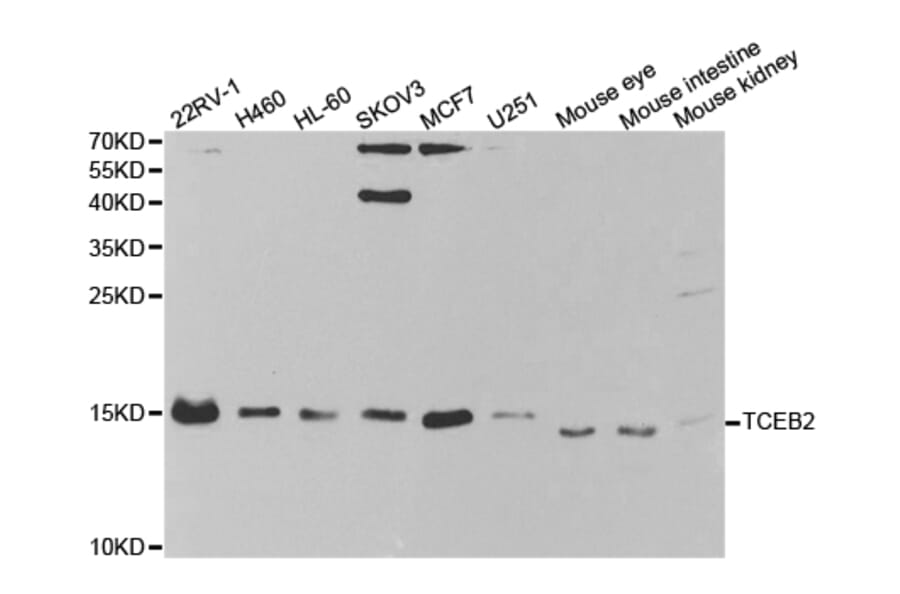 Western blot - TCEB2 Antibody from Signalway Antibody (32802) - Antibodies.com