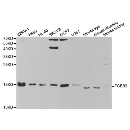 Western blot - TCEB2 Antibody from Signalway Antibody (32802) - Antibodies.com