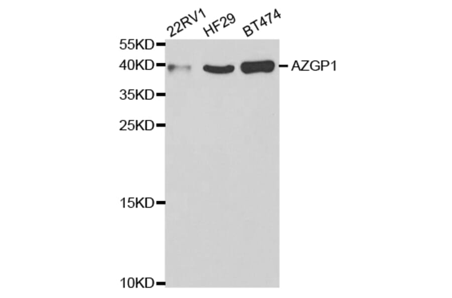 Western blot - AZGP1 Antibody from Signalway Antibody (32805) - Antibodies.com