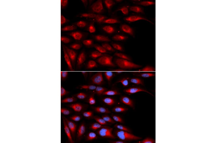 Immunofluorescence - AZGP1 Antibody from Signalway Antibody (32805) - Antibodies.com