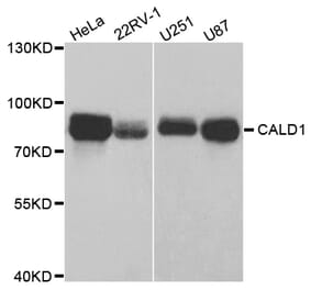 Western blot - CALD1 Antibody from Signalway Antibody (32806) - Antibodies.com