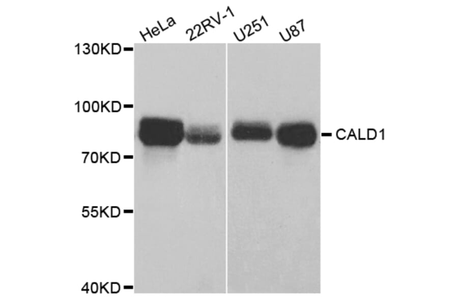 Western blot - CALD1 Antibody from Signalway Antibody (32806) - Antibodies.com