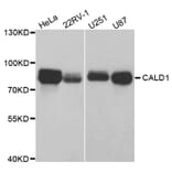 Western blot - CALD1 Antibody from Signalway Antibody (32806) - Antibodies.com