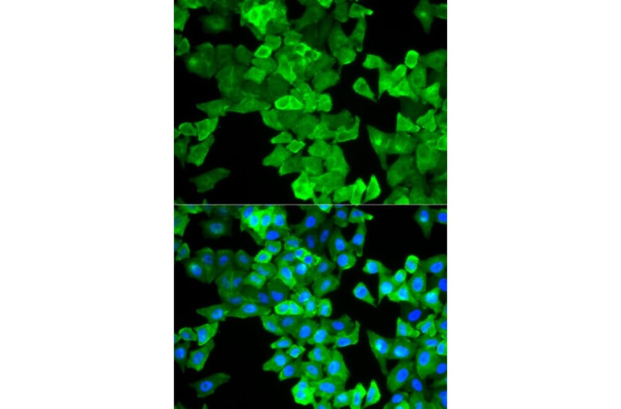 Immunofluorescence - CALD1 Antibody from Signalway Antibody (32806) - Antibodies.com