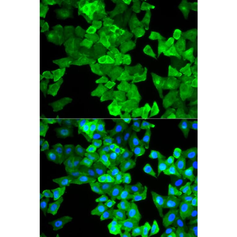 Immunofluorescence - CALD1 Antibody from Signalway Antibody (32806) - Antibodies.com