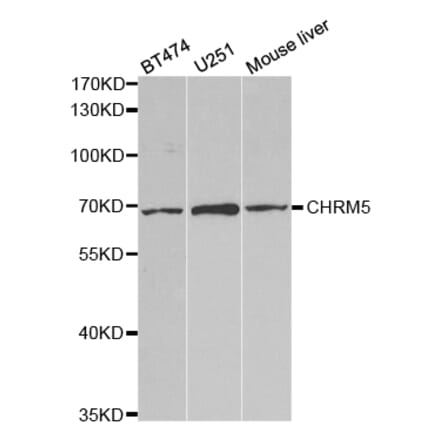 Western blot - CHRM5 Antibody from Signalway Antibody (32807) - Antibodies.com