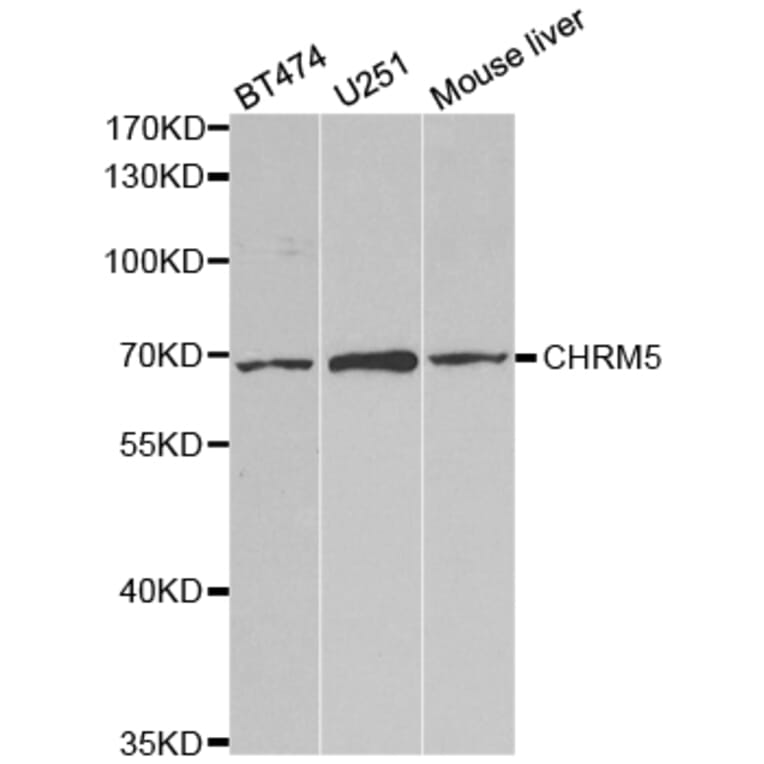 Western blot - CHRM5 Antibody from Signalway Antibody (32807) - Antibodies.com