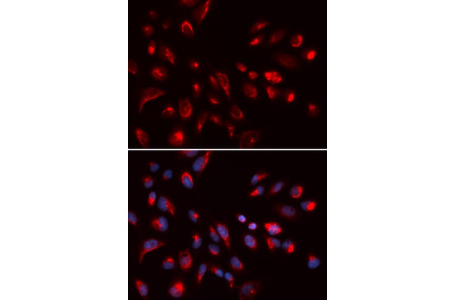 Immunofluorescence - CHRM5 Antibody from Signalway Antibody (32807) - Antibodies.com