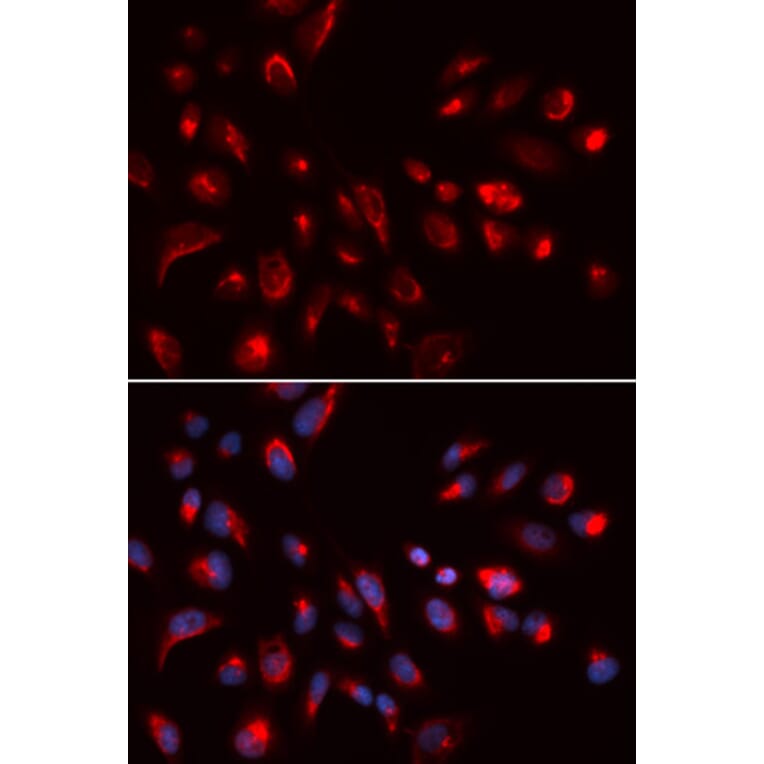 Immunofluorescence - CHRM5 Antibody from Signalway Antibody (32807) - Antibodies.com