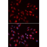 Immunofluorescence - CHRM5 Antibody from Signalway Antibody (32807) - Antibodies.com