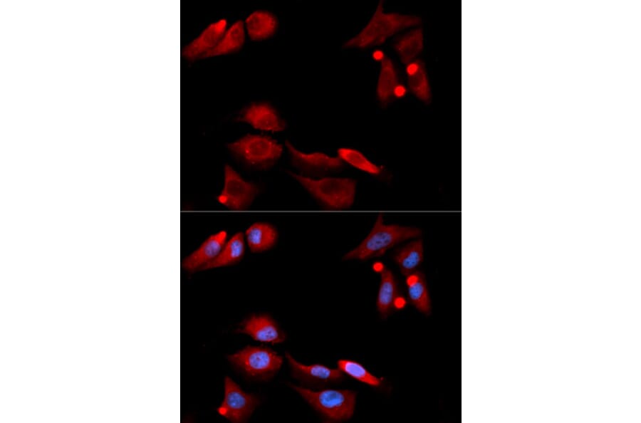 Immunofluorescence - GFRA1 Antibody from Signalway Antibody (32812) - Antibodies.com