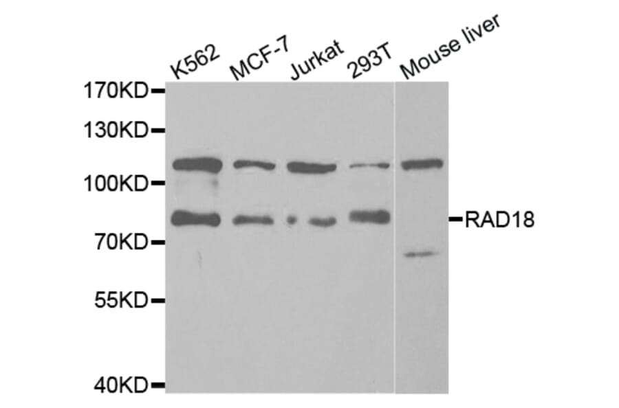 Western blot - RAD18 Antibody from Signalway Antibody (32817) - Antibodies.com