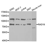 Western blot - RAD18 Antibody from Signalway Antibody (32817) - Antibodies.com