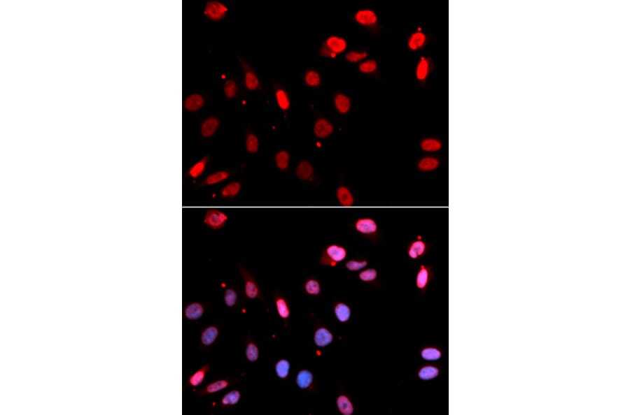 Immunofluorescence - RAD18 Antibody from Signalway Antibody (32817) - Antibodies.com