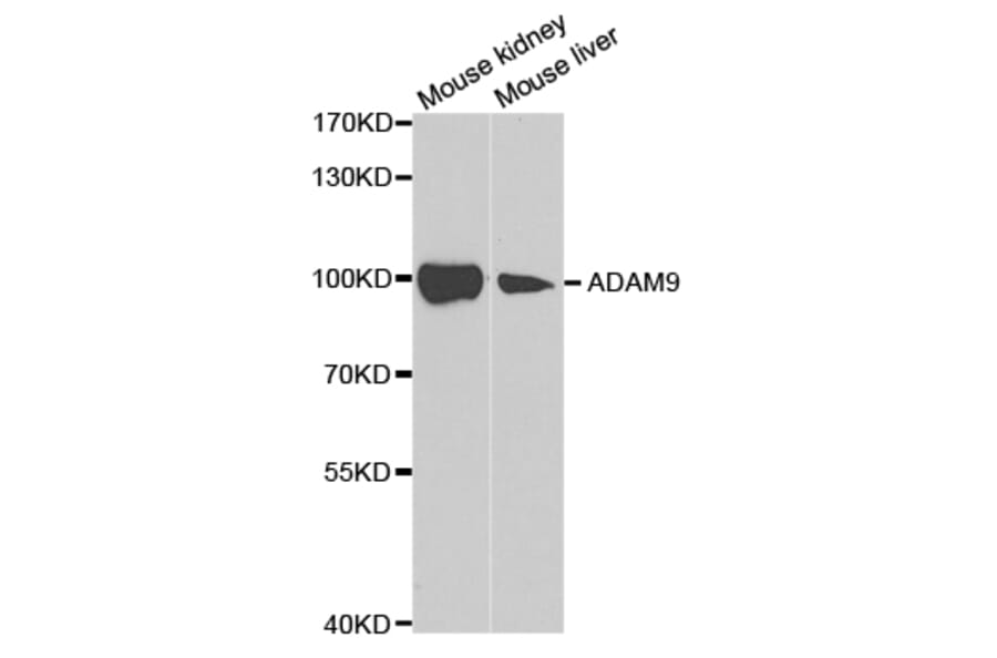 Western blot - ADAM9 Antibody from Signalway Antibody (32822) - Antibodies.com