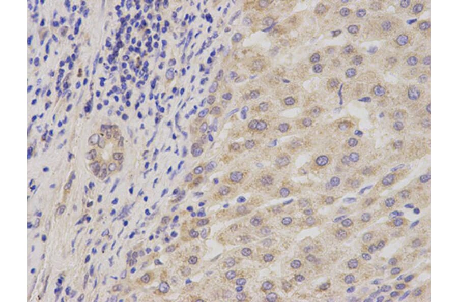 Immunohistochemistry - ADAM9 Antibody from Signalway Antibody (32822) - Antibodies.com